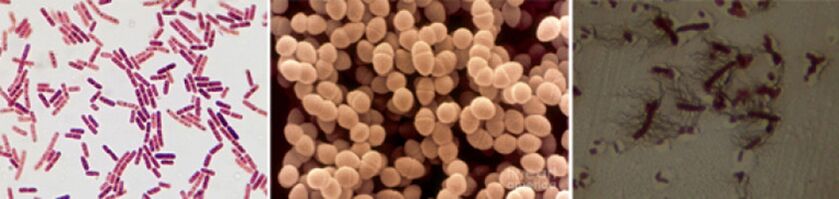 E. coli, enterococchi fecali e Proteus sono le principali cause di prostatite batterica cronica